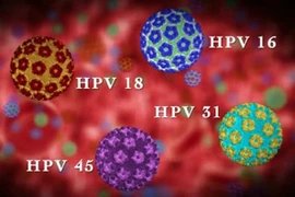 Bác sĩ chỉ rõ dương tính HPV có phải mắc ung thư cổ tử cung?