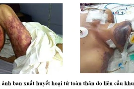 Nguy kịch do ăn tiết canh, thịt lợn: Phòng tránh thế nào?