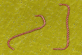 Du lịch rừng, suối cẩn thận mắc xoắn khuẩn Leptospira gây suy đa tạng