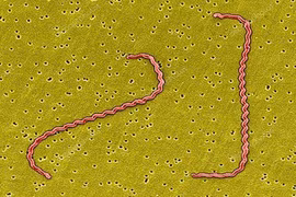Du lịch rừng, suối cẩn thận mắc xoắn khuẩn Leptospira gây suy đa tạng