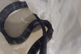 Nam giới 18 – 50 cẩn thận viêm mào tinh hoàn gây vô sinh