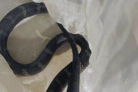 Nam giới 18 – 50 cẩn thận viêm mào tinh hoàn gây vô sinh