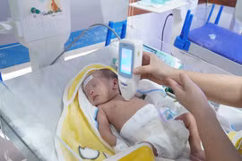 Vàng da có thể gây tổn thương não vĩnh viễn