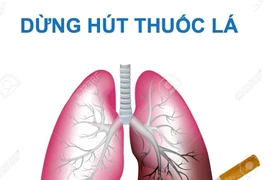 Bác sĩ chỉ rõ đối tượng cần tầm soát ung thư phổi: đừng để quá muộn