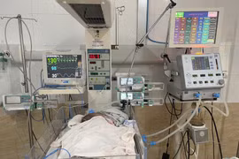 Cứu trẻ 39 ngày tuổi ngưng thở do nhiễm virus hợp bào hô hấp