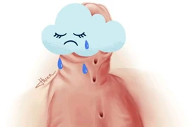 Lỗ tiểu thấp mổ sớm trả lại sự tự tin, chức năng sinh dục cho trẻ