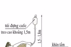 Thải độc đại tràng: có thải được độc hay cú lừa mang tính hệ thống?