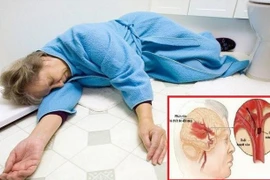 Nhiệt độ giảm sâu khiến đột quỵ não gia tăng?