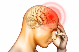 Bí kíp chữa thiểu năng tuần hoàn não