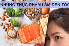 Món ăn bổ thận ngừa tóc bạc sớm
