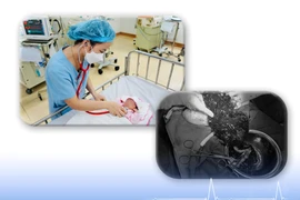 Cứu sống mẹ con sản phụ bị rau bong non thể nặng