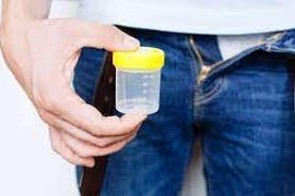 Bộ Y tế chấn chỉnh tình trạng mua bán tinh trùng tràn lan