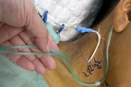 Ăn xôi tím bị ngộ độc tan máu và suy đa tạng