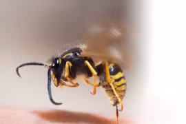 Bị ong vò vẽ đốt, người đàn ông 28 tuổi suy thận cấp