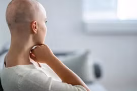 Chuyên gia mách cách chăm sóc tóc rụng ở bệnh nhân ung thư