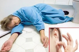 Dấu hiệu cơ thể cảnh báo đột quỵ trước 1 năm, cần biết để cứu mình