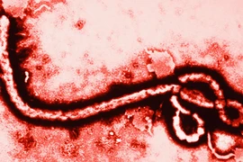 Lý giải nhiều bệnh nhân thoát chết khi nhiễm Ebola
