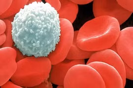 Nguyên nhân khiến trẻ mắc ung thư ngay từ khi lọt lòng