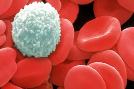 Nguyên nhân khiến trẻ mắc ung thư ngay từ khi lọt lòng