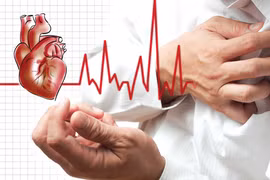 Dấu hiệu bệnh tim sắp tấn công bạn trong vòng 1 tháng