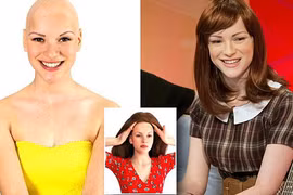 Cảm phục thiếu nữ gọt đầu ủng hộ bệnh nhân ung thư