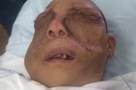 Ghê sợ khối u khổng lồ không tưởng nổi trên mặt