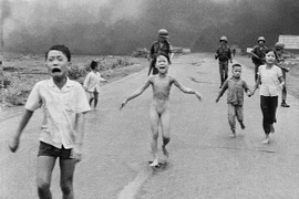 Hành trình chữa bỏng đau đớn của “em bé Napalm” Kim Phúc