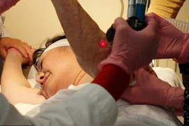Chi tiết quy trình trị sẹo bỏng bằng laser cho “em bé Napalm“