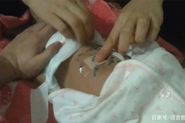 Dùng dao chích rốn con, mẹ trẻ khóc ròng vì sai lầm khủng khiếp này