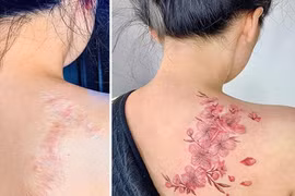 Mê mẩn hình xăm che sẹo của cô gái Việt gây sốt báo ngoại