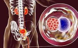 Top 10 bệnh lây truyền qua đường tình dục