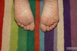 Bàn chân “ngàn vàng dẫn đến vinh hoa phú quý”