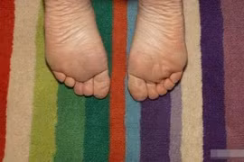 Bàn chân “ngàn vàng dẫn đến vinh hoa phú quý”