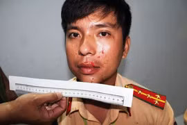 Nhóm thanh niên phê ma tuý giả danh cảnh sát hình sự, tấn công CSGT