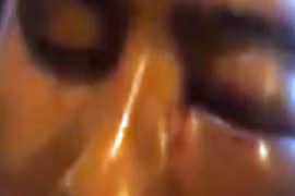 Cán bộ Ngân hàng Agribank “tự vệ”, nguyên chiến sĩ Công an suýt mù mắt