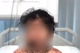 Bé gái bỗng "bỏng nặng" toàn thân sau khi uống thuốc tại phòng khám tư