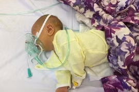 Lạng Sơn: Cắt rốn bằng kéo tại nhà, bé trai người Dao tử vong