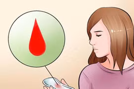 Dấu hiệu u xơ tử cung chị em nhất định phải nắm rõ