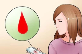 Dấu hiệu u xơ tử cung chị em nhất định phải nắm rõ