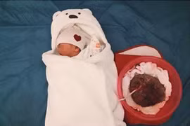 Tự đẻ tại nhà, bà mẹ không cắt rốn cho con, đặt con cạnh bánh nhau 6 ngày