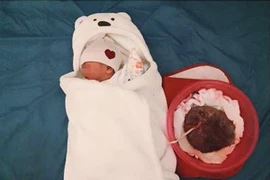 Tự đẻ tại nhà, bà mẹ không cắt rốn cho con, đặt con cạnh bánh nhau 6 ngày