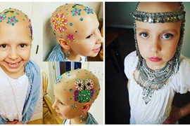 Con gái 7 tuổi bị rụng tóc, mẹ làm điều tuyệt vời không tưởng