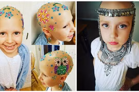 Con gái 7 tuổi bị rụng tóc, mẹ làm điều tuyệt vời không tưởng