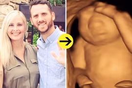 Mẹ đau đớn sinh con không não để cứu con người khác