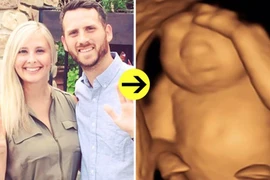 Mẹ đau đớn sinh con không não để cứu con người khác