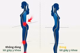 Chọn giày dép đúng cách tránh bệnh cột sống