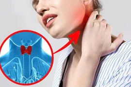 Bệnh tuyến giáp ngày càng tăng, phòng ngừa thế nào?