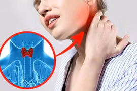 Bệnh tuyến giáp ngày càng tăng, phòng ngừa thế nào?