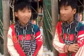 Chú ruột quấn xích quanh cổ cháu đến công an trình diện