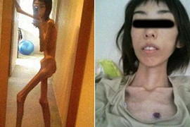 Thiếu nữ Nhật tố cáo từng bị ông nội bỏ đói, gầy như bộ xương khô